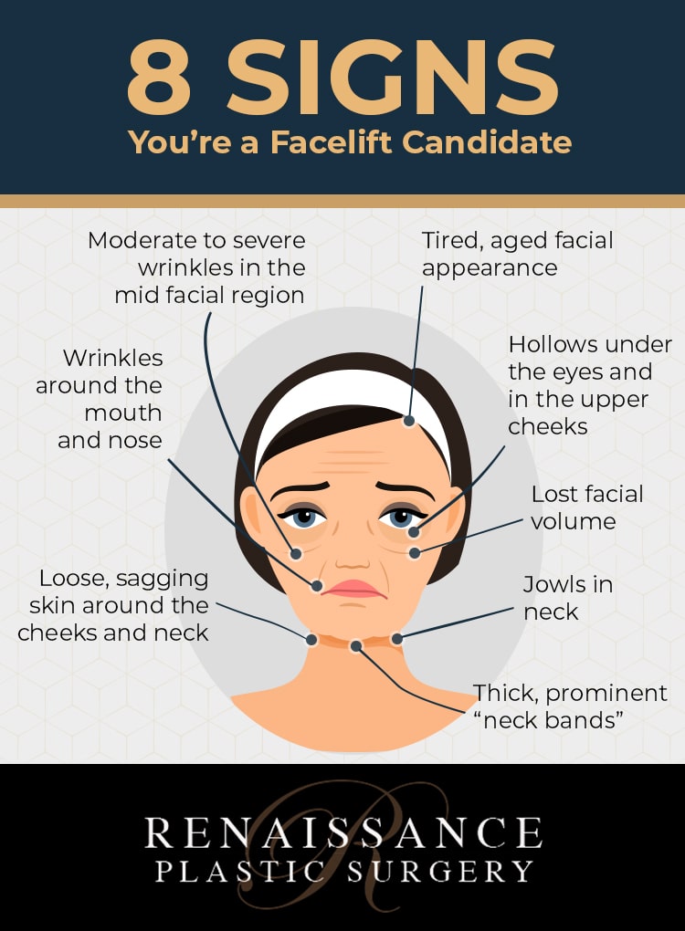 facelift candidate